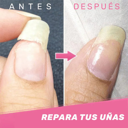 Gel Reparador de Uñas - NailMend